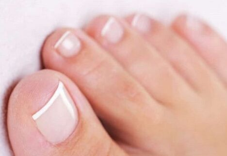 Nail health