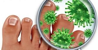 How to treat fungal infection on the fingers
