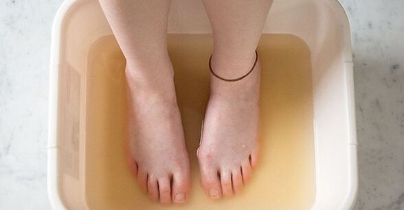 Iodine bath to treat nail fungus.